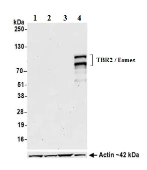 Western blot - Anti-TBR2 / Eomes antibody [BLR104H] - BSA free (AB275960)