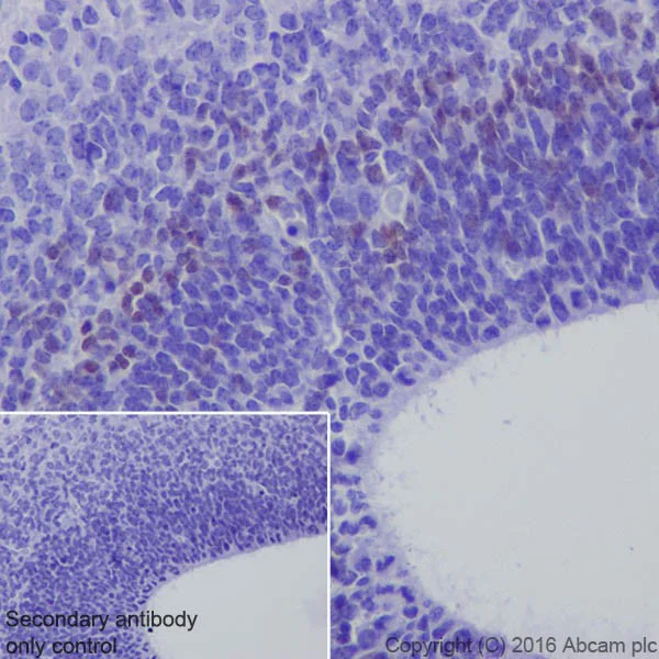 Immunohistochemistry (Formalin/PFA-fixed paraffin-embedded sections) - Anti-TBR2 / Eomes antibody [EPR19012] (AB183991)