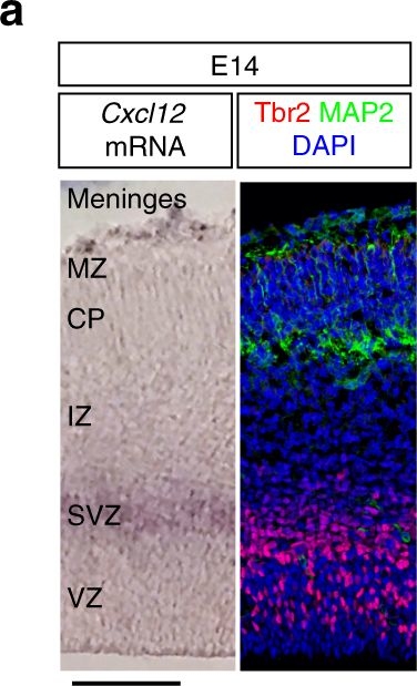 Immunohistochemistry - Anti-TBR2 / Eomes antibody [EPR19012] (AB183991)