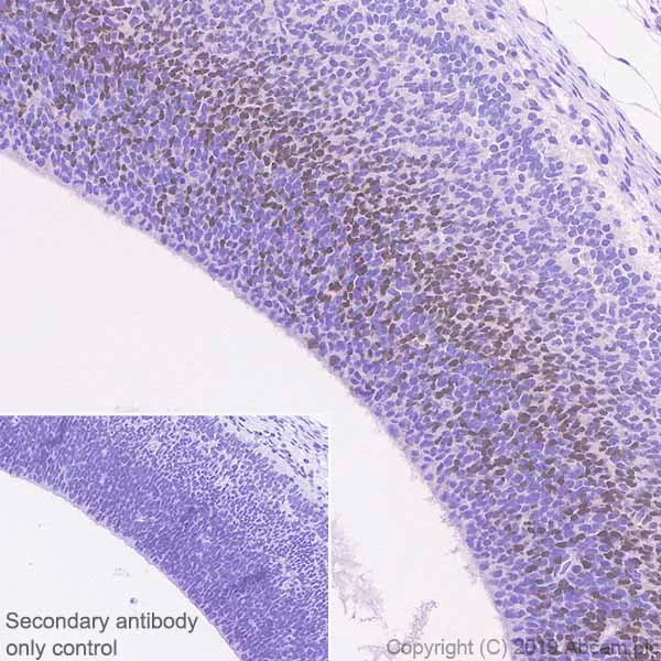 Immunohistochemistry (Formalin/PFA-fixed paraffin-embedded sections) - Anti-TBR2 / Eomes antibody [EPR21950-241] (AB216870)