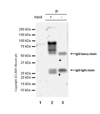 Immunoprecipitation - Anti-TBR2 / Eomes antibody [EPR21950-241] - BSA and Azide free (AB261913)