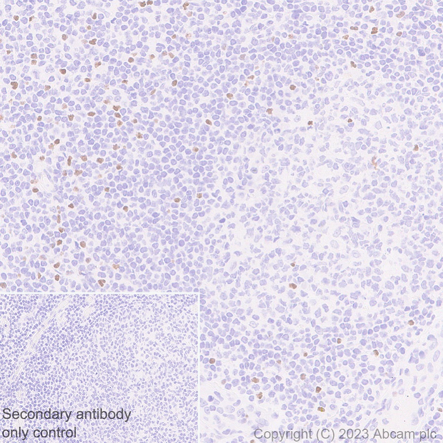 Immunohistochemistry (Formalin/PFA-fixed paraffin-embedded sections) - Anti-TBR2 / Eomes antibody [EPR26474-17] (ab315794), expandable thumbnail
