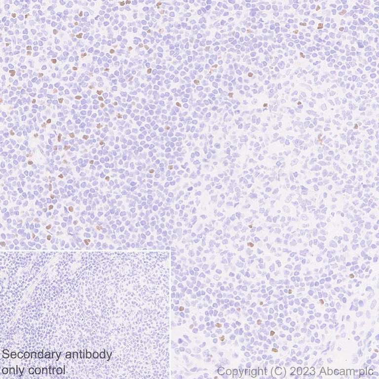 Immunohistochemistry (Formalin/PFA-fixed paraffin-embedded sections) - Anti-TBR2 / Eomes antibody [EPR26474-17] (AB315794)