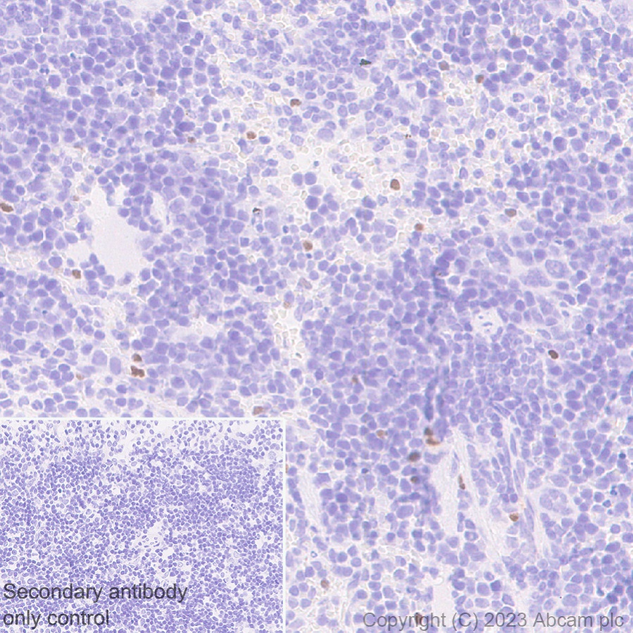 Immunohistochemistry (Formalin/PFA-fixed paraffin-embedded sections) - Anti-TBR2 / Eomes antibody [EPR26474-17] (ab315794), expandable thumbnail