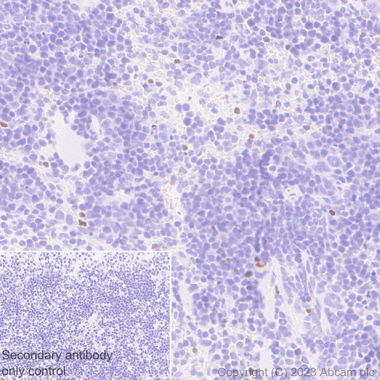 Immunohistochemistry (Formalin/PFA-fixed paraffin-embedded sections) - Anti-TBR2 / Eomes antibody [EPR26474-17] (AB315794)