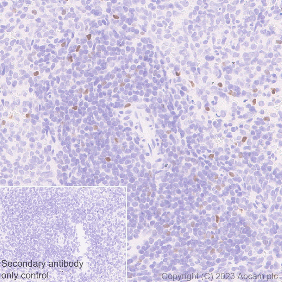 Immunohistochemistry (Formalin/PFA-fixed paraffin-embedded sections) - Anti-TBR2 / Eomes antibody [EPR26474-17] (ab315794), expandable thumbnail