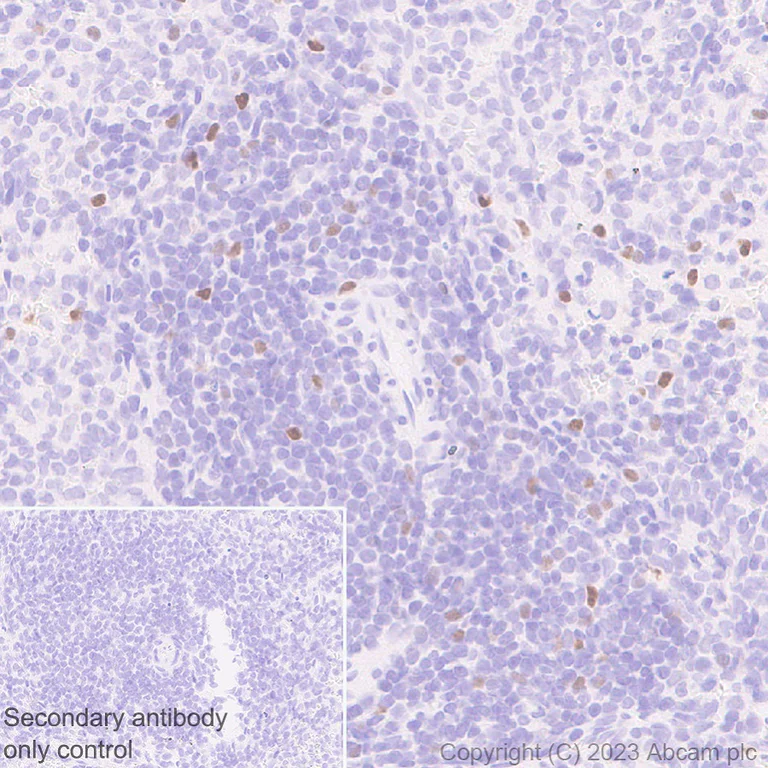 Immunohistochemistry (Formalin/PFA-fixed paraffin-embedded sections) - Anti-TBR2 / Eomes antibody [EPR26474-17] (AB315794)