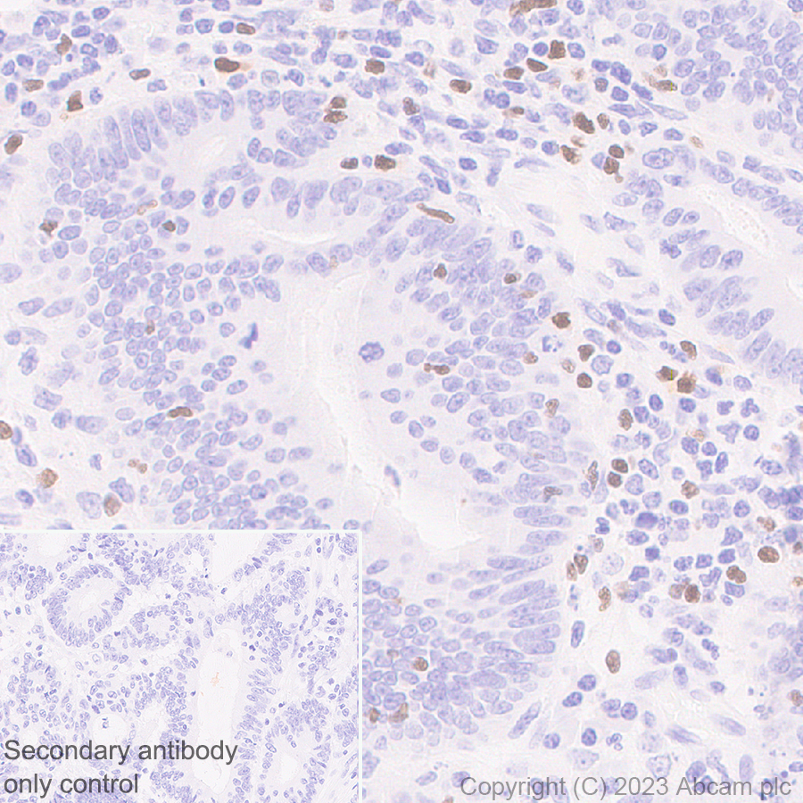 Immunohistochemistry (Formalin/PFA-fixed paraffin-embedded sections) - Anti-TBR2 / Eomes antibody [EPR26474-17] (ab315794), expandable thumbnail