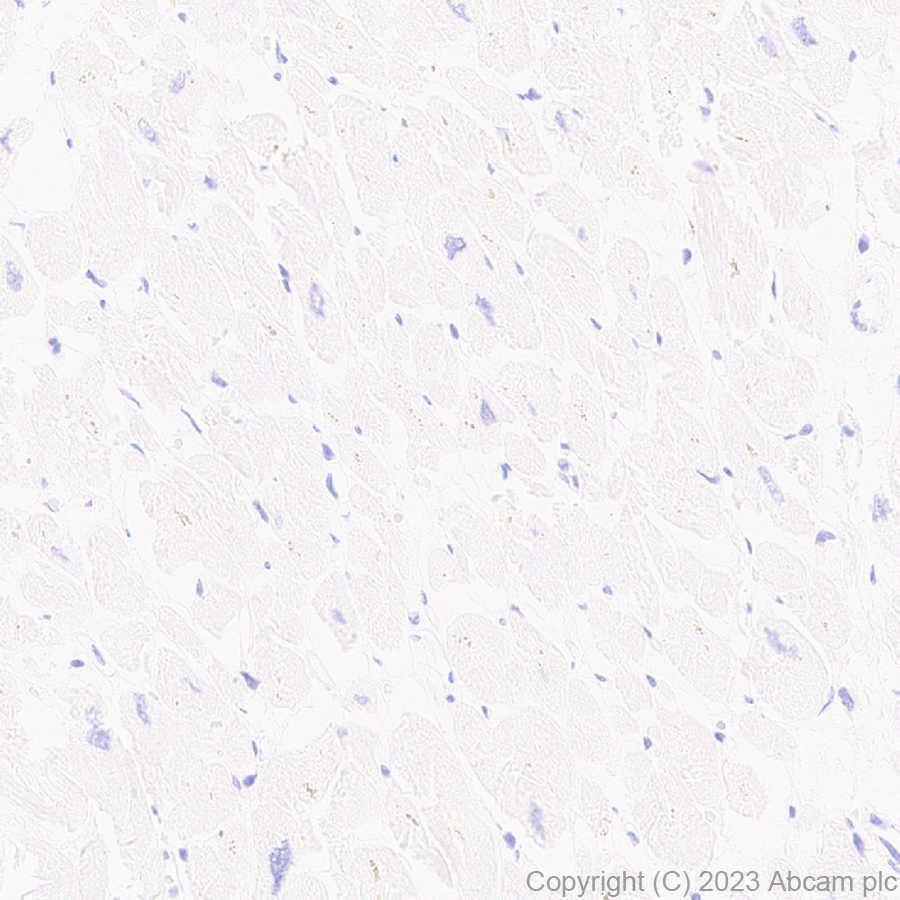 Immunohistochemistry (Formalin/PFA-fixed paraffin-embedded sections) - Anti-TBR2 / Eomes antibody [EPR26474-17] (ab315794), expandable thumbnail