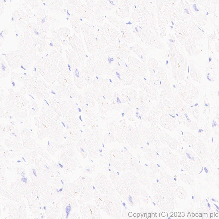 Immunohistochemistry (Formalin/PFA-fixed paraffin-embedded sections) - Anti-TBR2 / Eomes antibody [EPR26474-17] (AB315794)