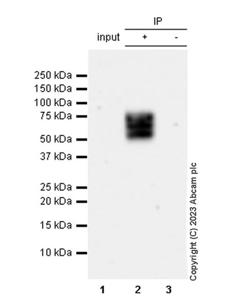 Immunoprecipitation - Anti-TBR2 / Eomes antibody [EPR26474-17] (AB315794), expandable thumbnail