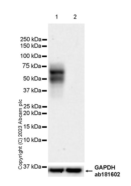 Western blot - Anti-TBR2 / Eomes antibody [EPR26474-17] (AB315794), expandable thumbnail