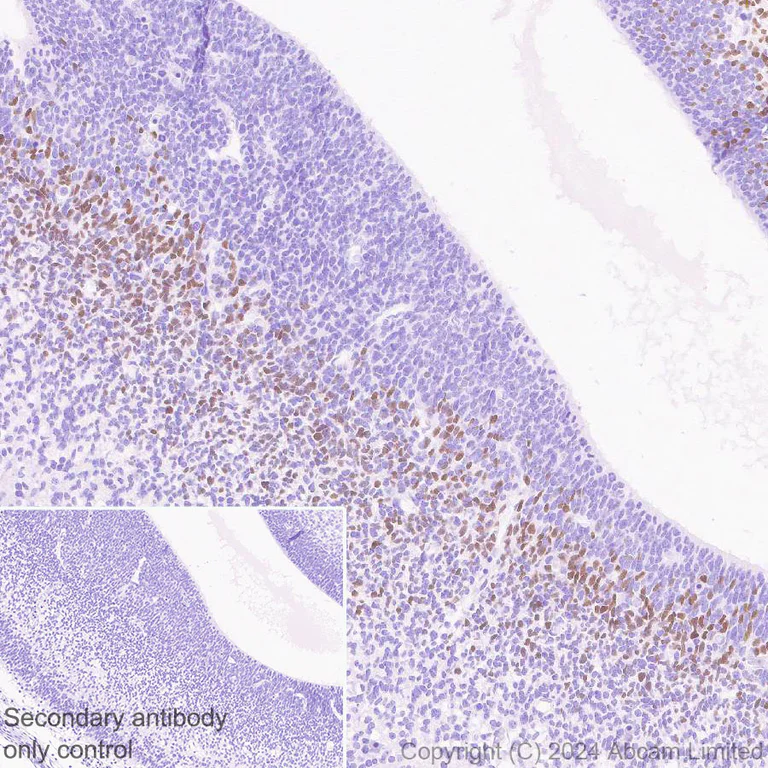 Immunohistochemistry (Formalin/PFA-fixed paraffin-embedded sections) - Anti-TBR2 / Eomes antibody [RM2055] (AB319166)
