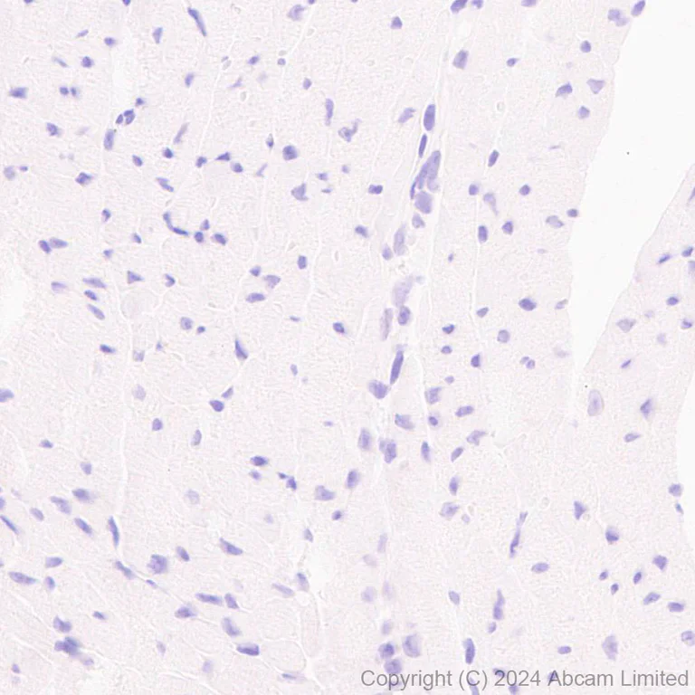 Immunohistochemistry (Formalin/PFA-fixed paraffin-embedded sections) - Anti-TBR2 / Eomes antibody [RM2055] (AB319166)