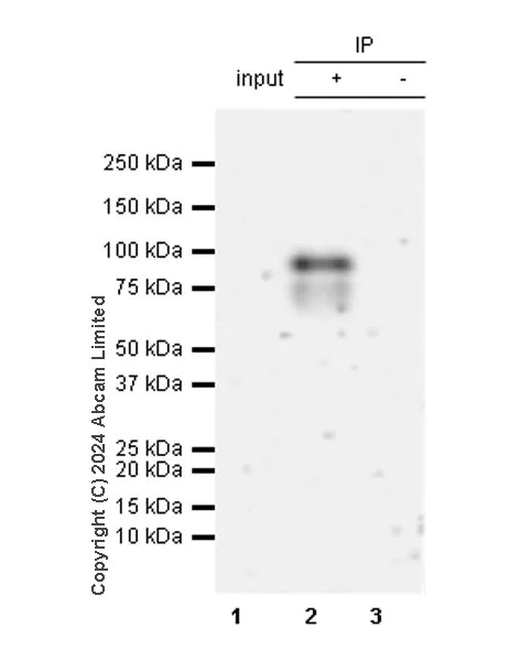 Immunoprecipitation - Anti-TBR2 / Eomes antibody [RM2055] (AB319166)