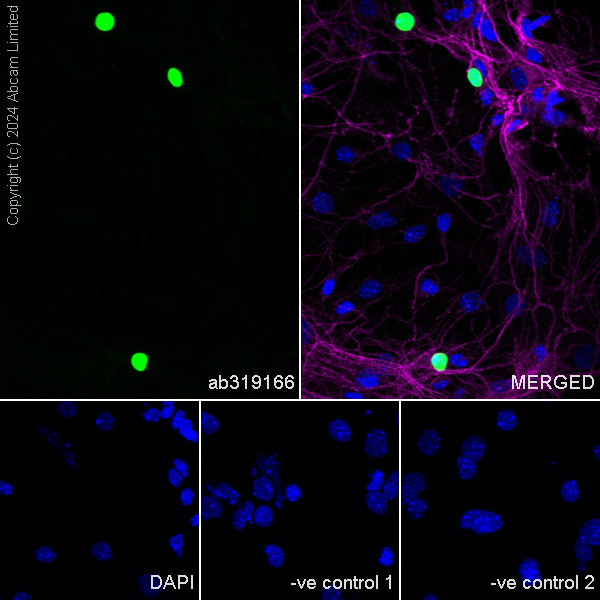 Immunocytochemistry/ Immunofluorescence - Anti-TBR2 / Eomes antibody [RM2055] - BSA and Azide free (ab319167), expandable thumbnail