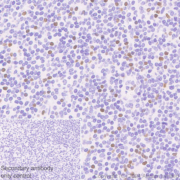 Immunohistochemistry (Formalin/PFA-fixed paraffin-embedded sections) - Anti-TBR2 / Eomes antibody [RM2055] - BSA and Azide free (AB319167)