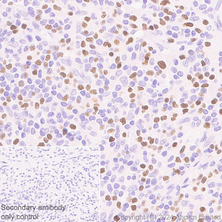 Immunohistochemistry (Formalin/PFA-fixed paraffin-embedded sections) - Anti-TBR2 / Eomes antibody [RM2055] - BSA and Azide free (AB319167)