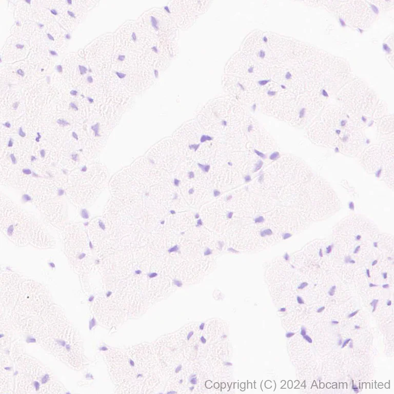 Immunohistochemistry (Formalin/PFA-fixed paraffin-embedded sections) - Anti-TBR2 / Eomes antibody [RM2055] - BSA and Azide free (AB319167)