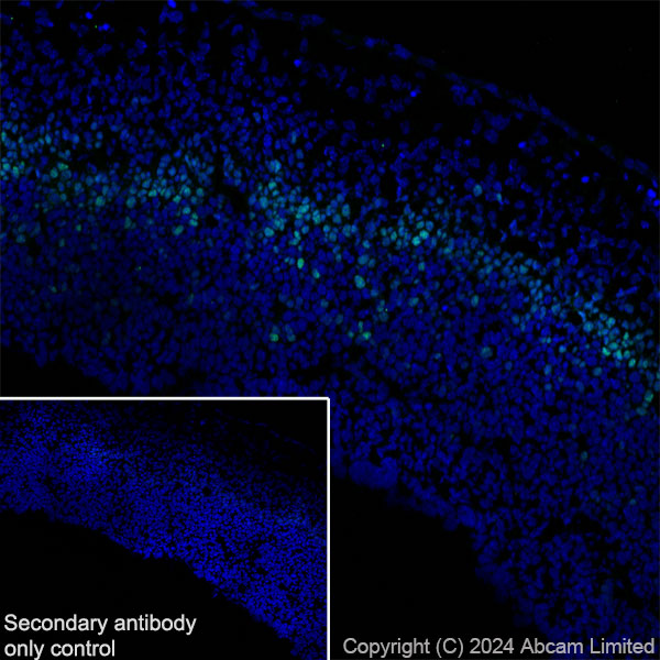 Immunohistochemistry (Frozen sections) - Anti-TBR2 / Eomes antibody [RM2055] - BSA and Azide free (AB319167), expandable thumbnail