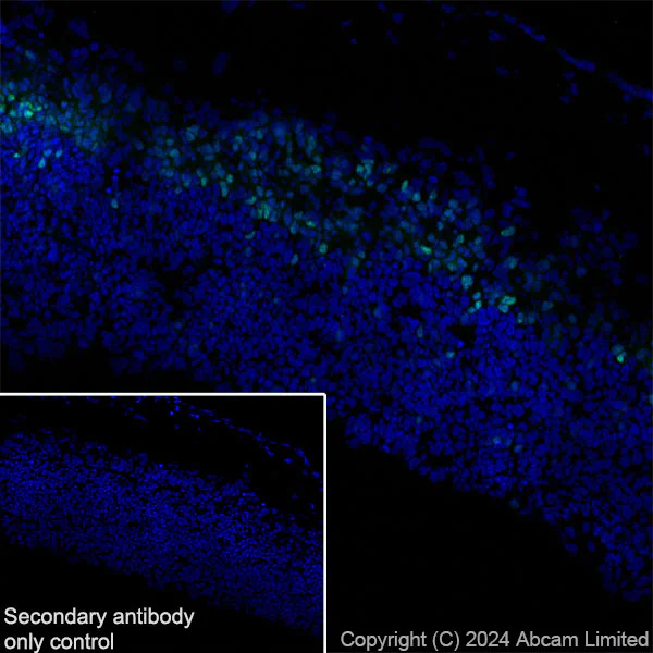 Immunohistochemistry (Frozen sections) - Anti-TBR2 / Eomes antibody [RM2055] - BSA and Azide free (AB319167)