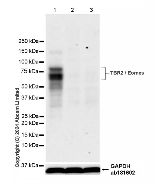 Western blot - Anti-TBR2 / Eomes antibody [RM2055] - BSA and Azide free (ab319167), expandable thumbnail