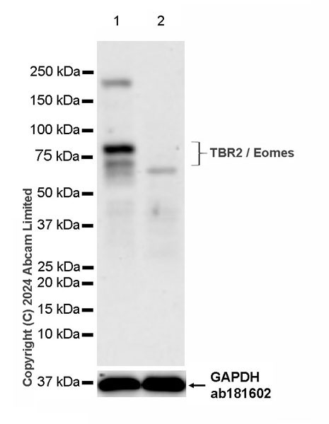 Western blot - Anti-TBR2 / Eomes antibody [RM2055] - BSA and Azide free (ab319167), expandable thumbnail