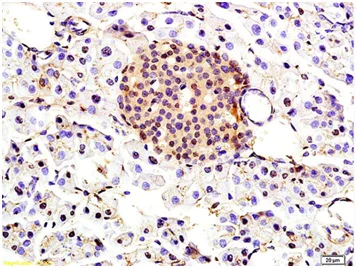 Immunohistochemistry (Formalin/PFA-fixed paraffin-embedded sections) - Anti-TBRG1 antibody (AB203276)