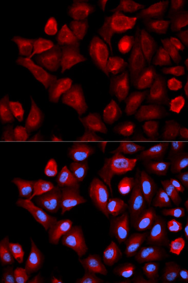 Immunocytochemistry/ Immunofluorescence - Anti-TBRG4 antibody (AB180775)