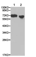 Western blot - Anti-TBRG4 antibody (AB180775)