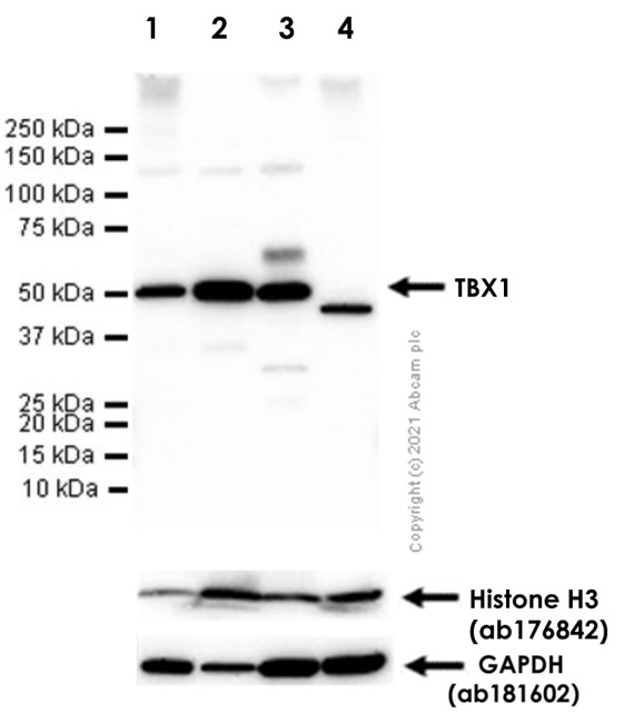 Western blot - Anti-TBX1 antibody [EPR3289(2)] - BSA and Azide free (AB239967)