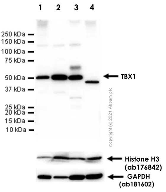 Western blot - Anti-TBX1 antibody [EPR3289(2)] - BSA and Azide free (AB239967)