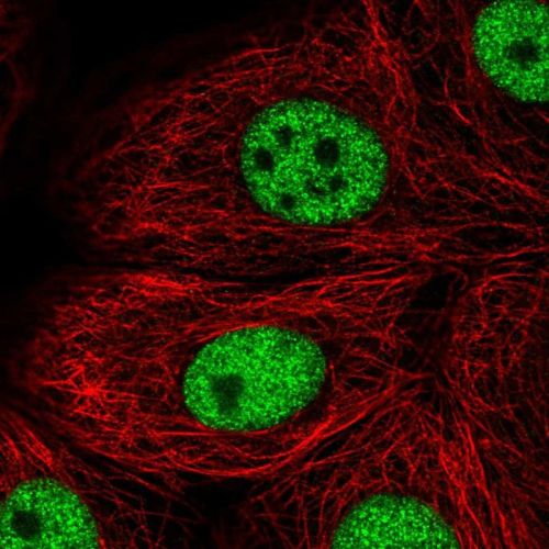 Immunocytochemistry/ Immunofluorescence - Anti-Tbx2 antibody (AB244305)