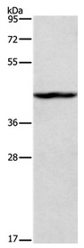 Western blot - Anti-Tbx20 antibody (AB197386)