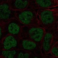 Immunocytochemistry/ Immunofluorescence - Anti-TBX3 Antibody (AB327282)