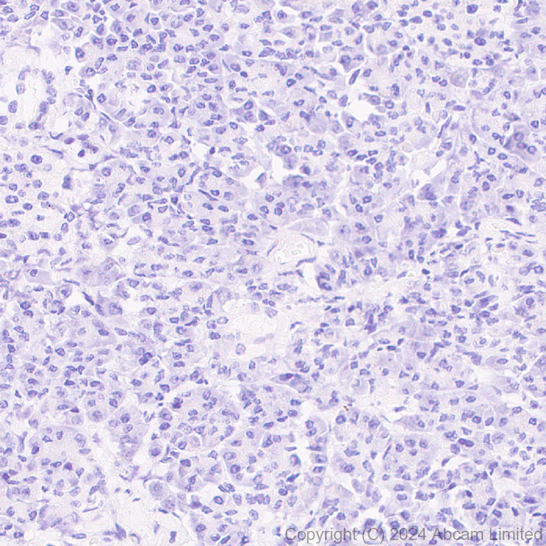 Immunohistochemistry (Formalin/PFA-fixed paraffin-embedded sections) - Anti-TBX3 antibody [EPR28578-38] (AB322199)