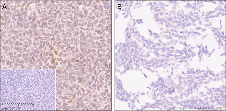 Immunohistochemistry (Formalin/PFA-fixed paraffin-embedded sections) - Anti-TBX3 antibody [EPR28578-38] - BSA and Azide free (AB324776)
