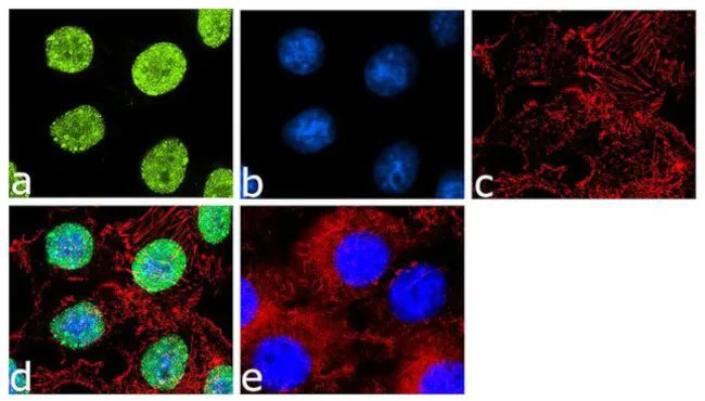 Immunocytochemistry/ Immunofluorescence - Anti-Tbx3 Antibody [RP23040141] (AB313456)