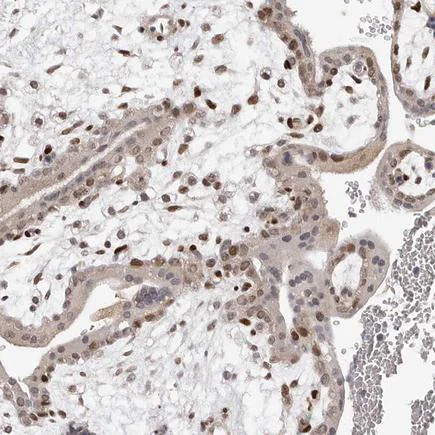 Immunohistochemistry (Formalin/PFA-fixed paraffin-embedded sections) - Anti-TBX5 antibody (AB223760)