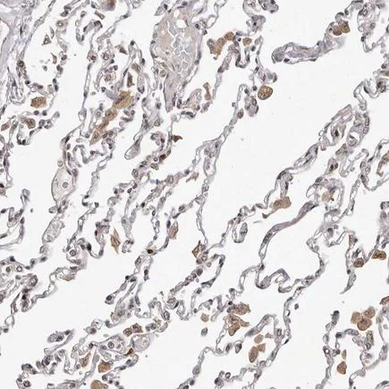 Immunohistochemistry (Formalin/PFA-fixed paraffin-embedded sections) - Anti-TBX5 antibody (AB223760)