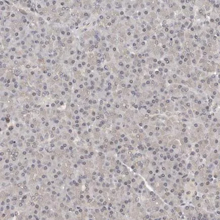 Immunohistochemistry (Formalin/PFA-fixed paraffin-embedded sections) - Anti-TBX5 antibody (AB223760)
