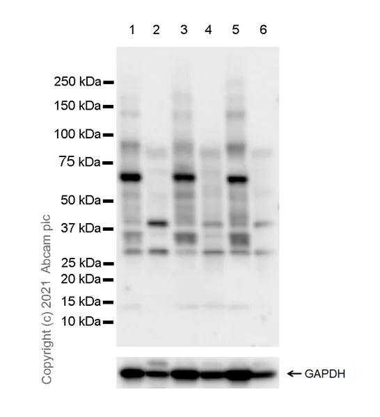 Western blot - Anti-TBX5 antibody [EPR23798-102] - BSA and Azide free (AB281835)