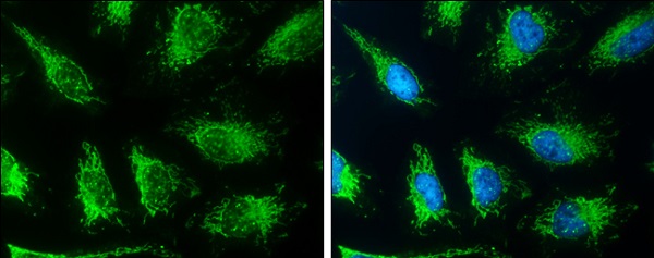 Immunocytochemistry/ Immunofluorescence - Anti-TC1 antibody (AB229680), expandable thumbnail