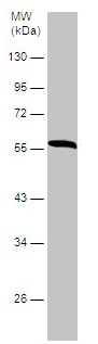 Western blot - Anti-TC1 antibody (AB229680), expandable thumbnail