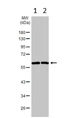 Western blot - Anti-TC1 antibody (AB229680)