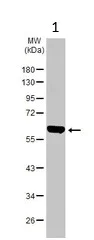 Western blot - Anti-TC1 antibody (AB229680)