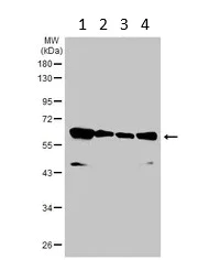 Western blot - Anti-TC1 antibody (AB229680)