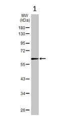 Western blot - Anti-TC1 antibody (AB229680)