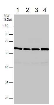 Western blot - Anti-TC1 antibody (AB229680), expandable thumbnail