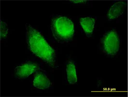 Immunocytochemistry/ Immunofluorescence - Anti-TC10 antibody (AB168645)